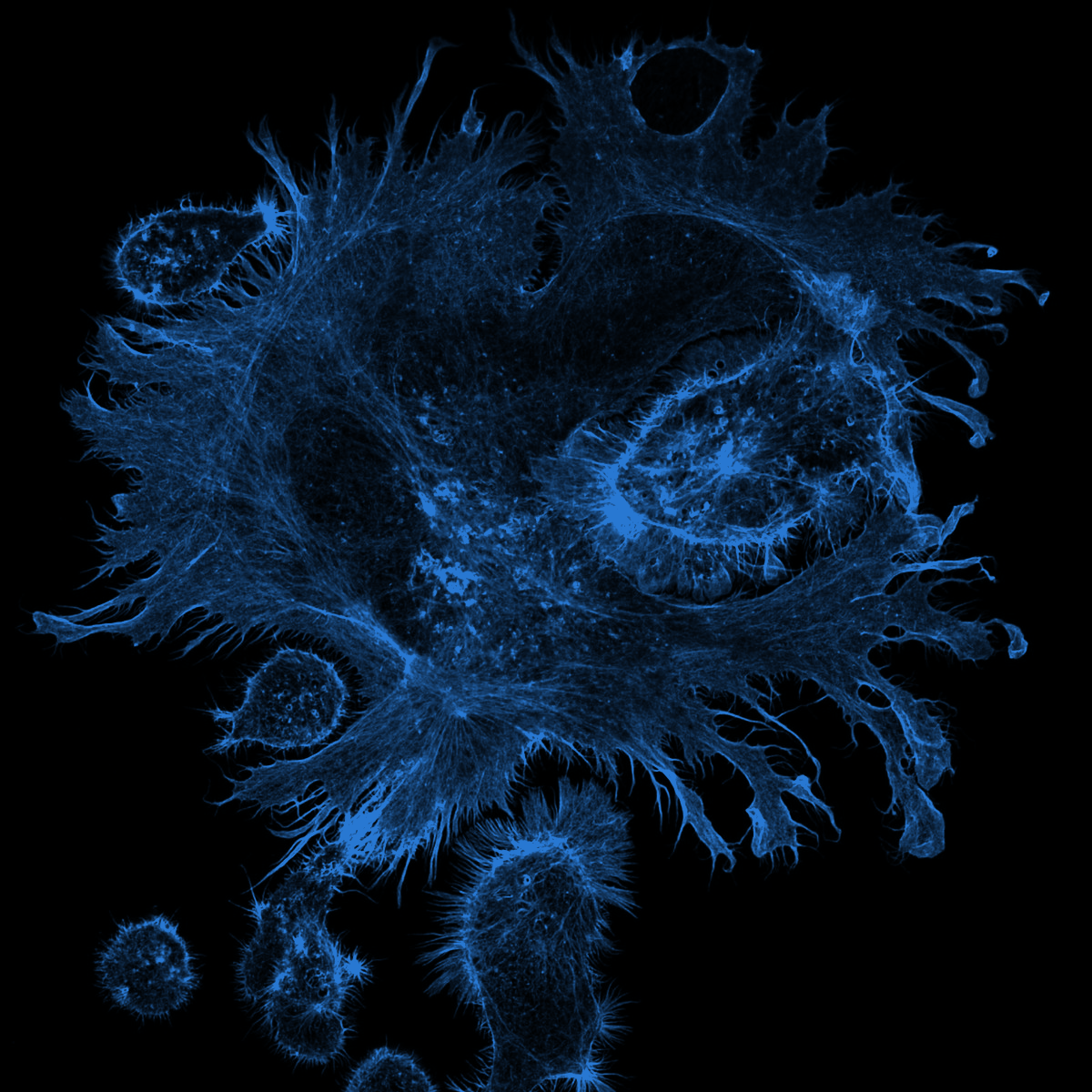 Fluorescence microscopy of a cell